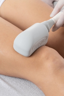 cryo 1 Laser Vasculaire Cabinet Clairefeulle